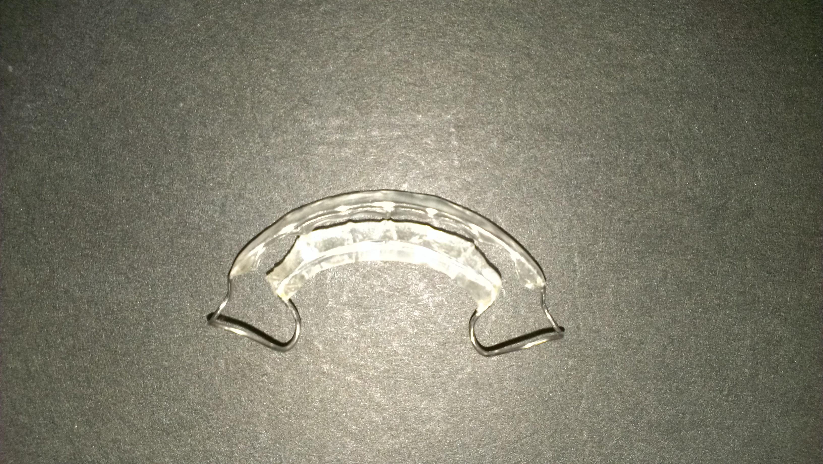 Spring Aligners